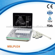 MSLPU24 Erschwingliche Laptop tragbare Ultraschall-Scanner Hersteller